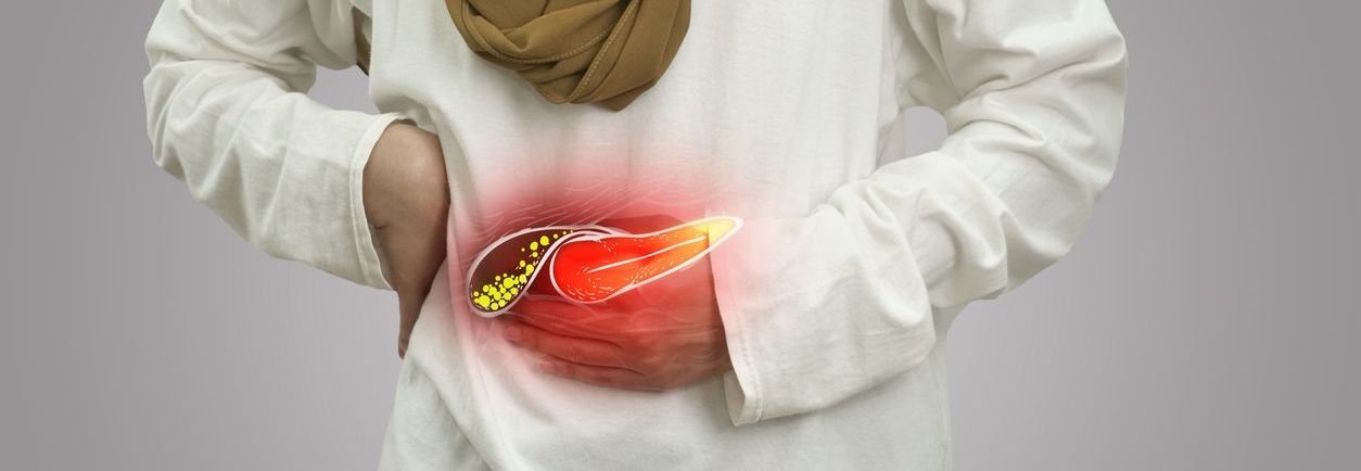 Bono PAD Colelitiasis