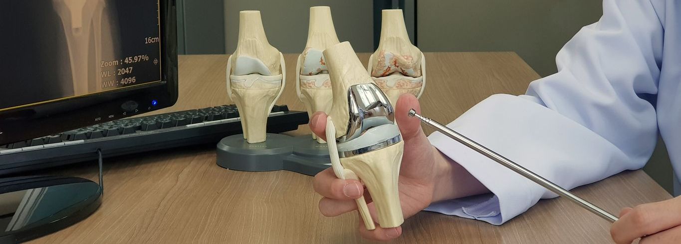 Tu cirugía de prótesis de rodilla con SAP Fonasa